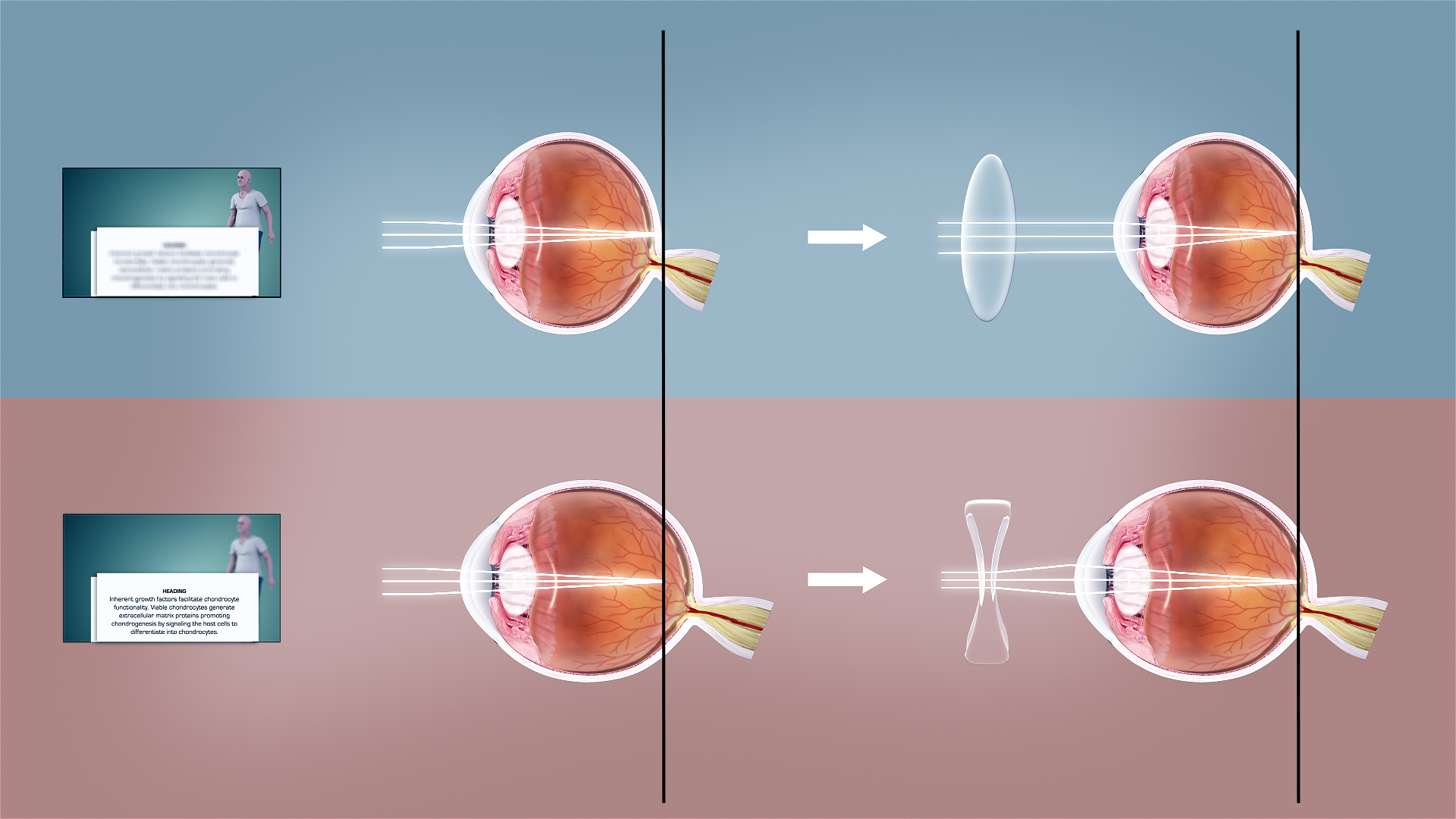 Refractive Error Eye Treatment in Malad, Borivali, Goregaon, Mumbai